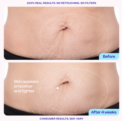 Belly Bloom Abdominal Cream